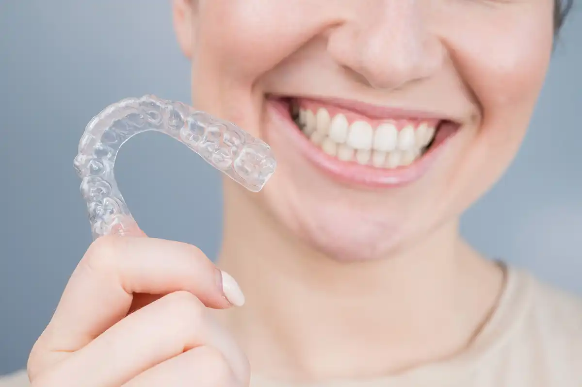 Orthodontics bite correction appliance using Invisalign