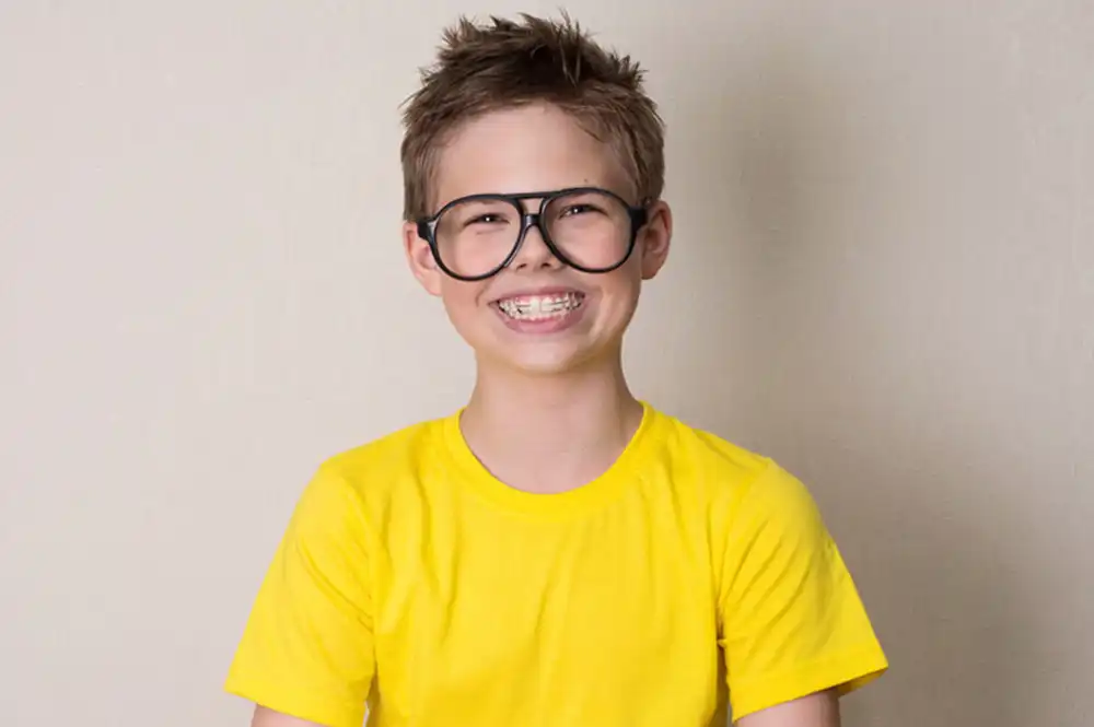 Braces-Ortho wire braces shown