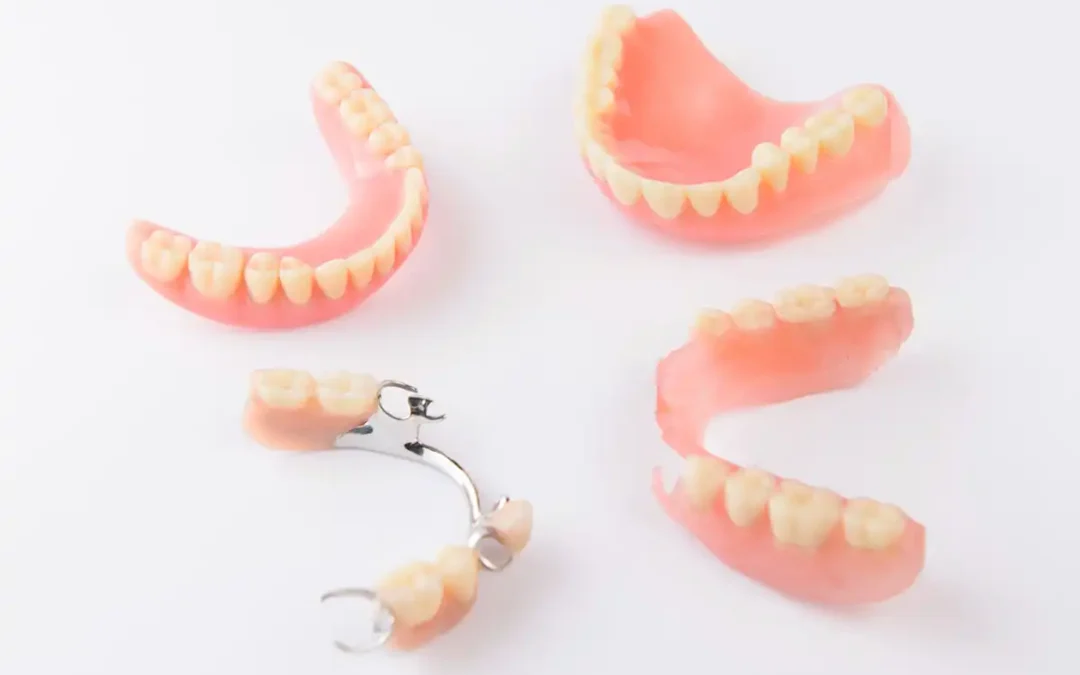 Types of Dentures