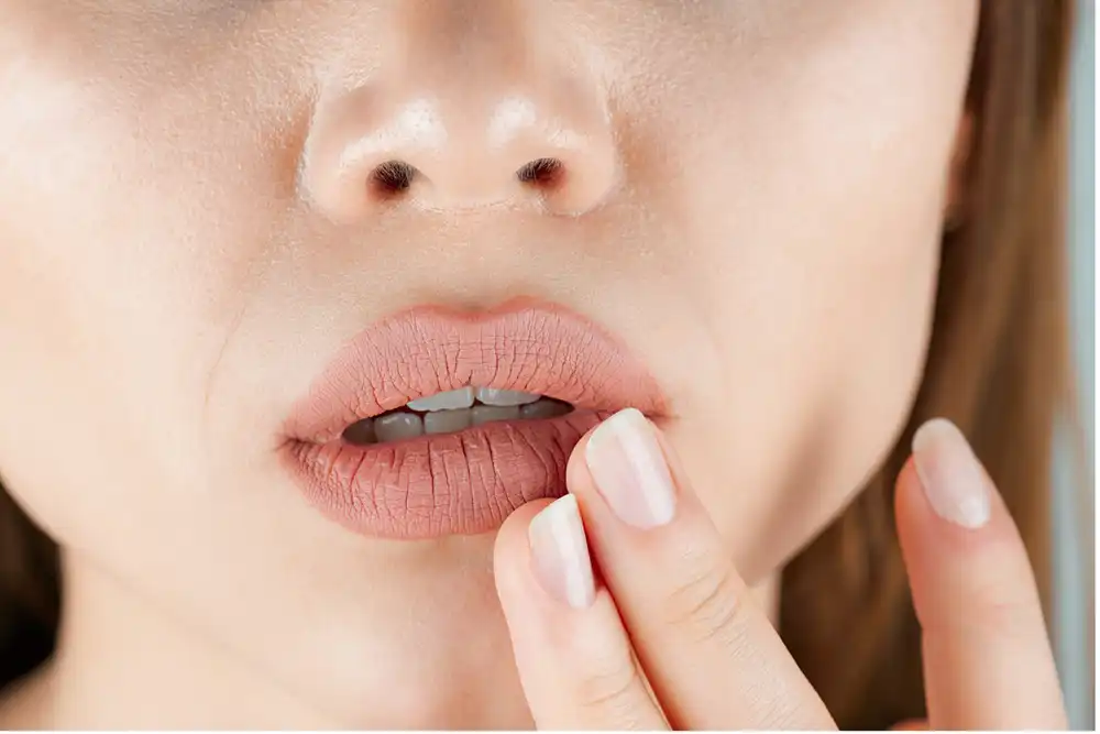 Dry Mouth Cracked lips