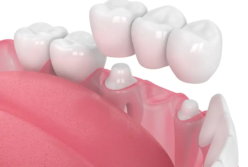 Restorative Dentistry