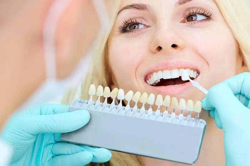 veneers Cosmetic Dentistry applying veneers to woman's teeth