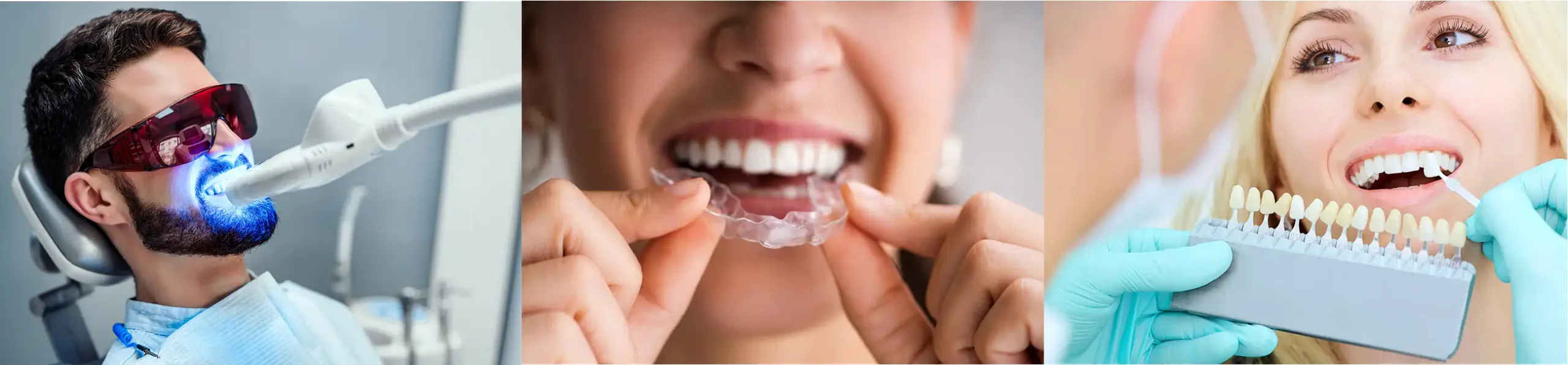 Three different people cosmetic dentistry with teeth whitening devices.