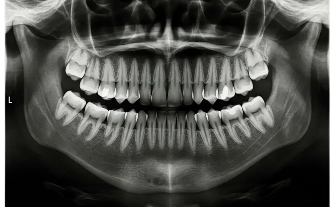 Panorex Imaging Parr Dental